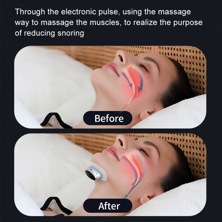 Luniv™ Anti-Snoring Device – Wireless & Mouth-Free